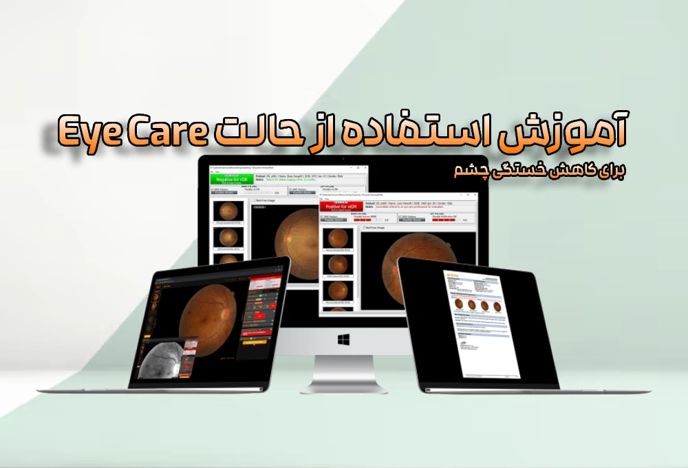 آموزش استفاده از حالت Eye Care برای کاهش خستگی چشم 4 آموزش استفاده از حالت Eye Care برای کاهش خستگی چشم